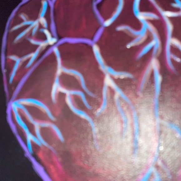 Original Heart - Picture 4 of 5